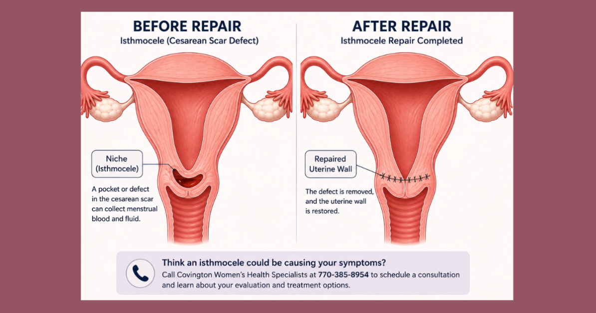 Medical diagram of an isthmocele, or Cesarean scar defect, before and after surgical repair